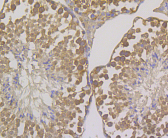 OS9 Rabbit mAb