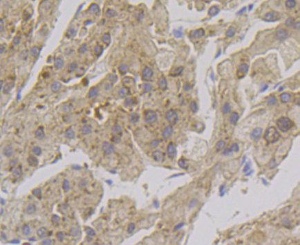 Alcohol Dehydrogenase Rabbit mAb