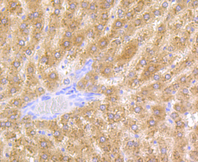 Alcohol Dehydrogenase Rabbit mAb