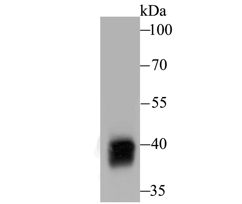 Alcohol Dehydrogenase Rabbit mAb