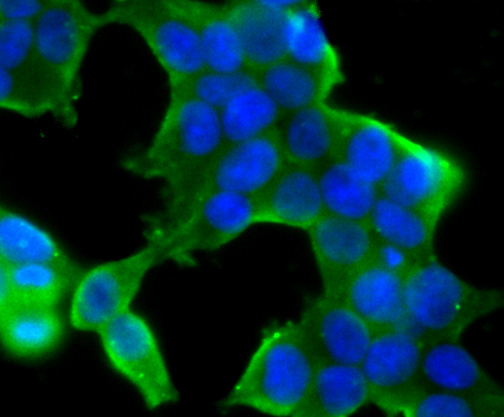 STUB1 Rabbit mAb