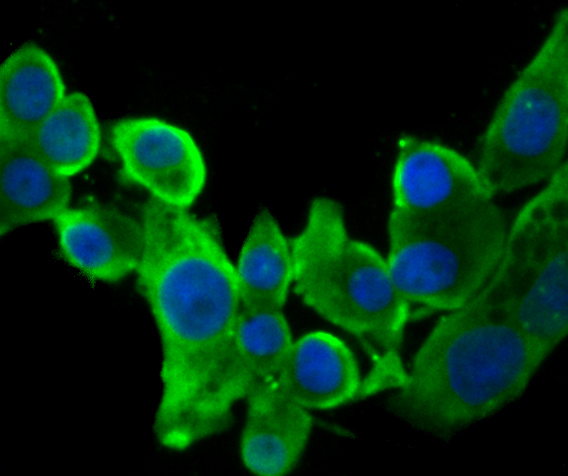 STUB1 Rabbit mAb