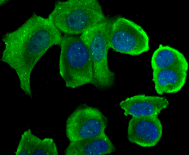 STUB1 Rabbit mAb