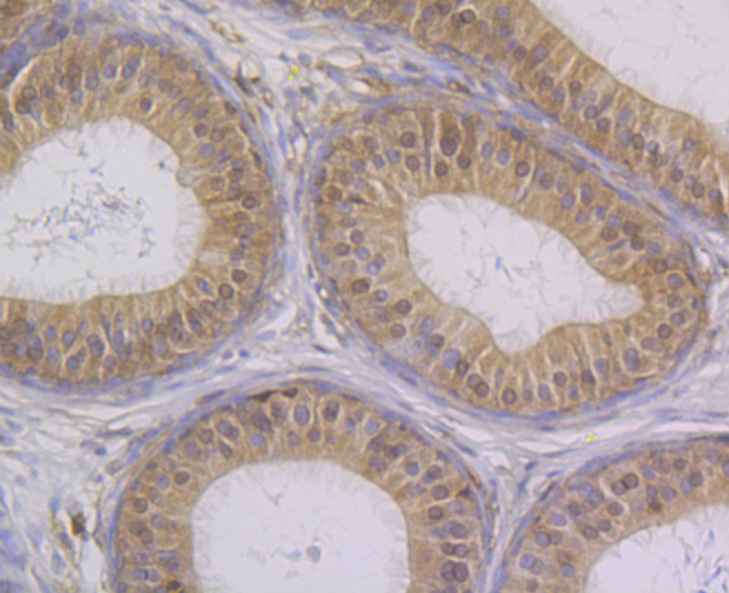 STUB1 Rabbit mAb