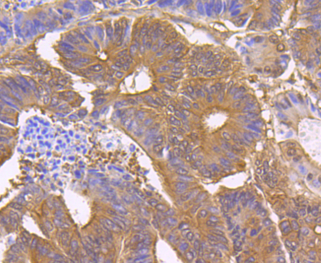 STUB1 Rabbit mAb