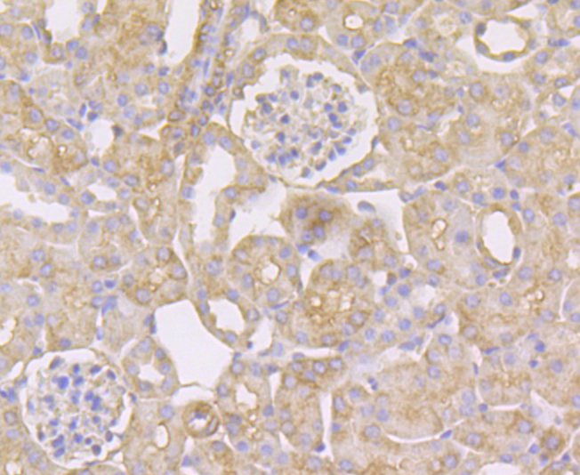 STUB1 Rabbit mAb