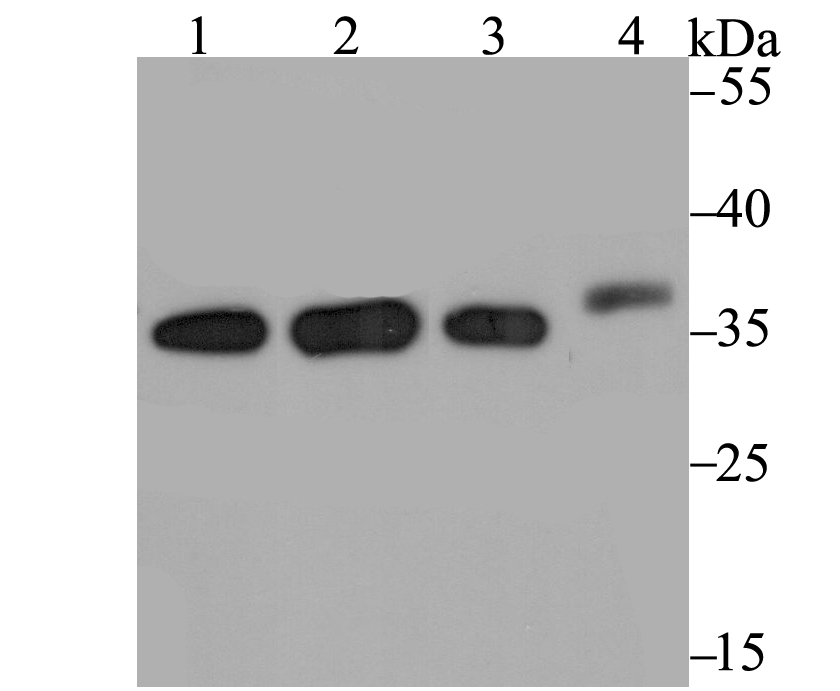 STUB1 Rabbit mAb