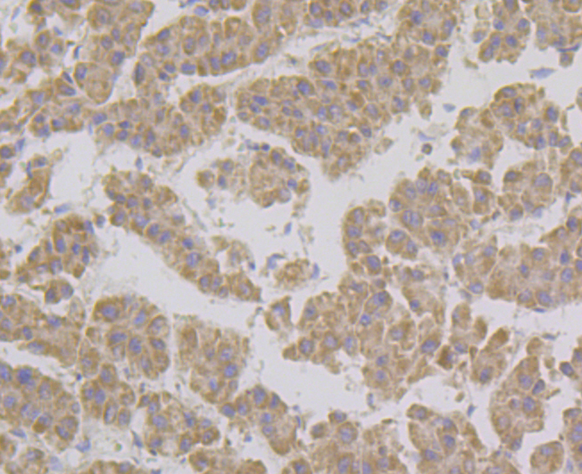 GRIM19 Rabbit mAb