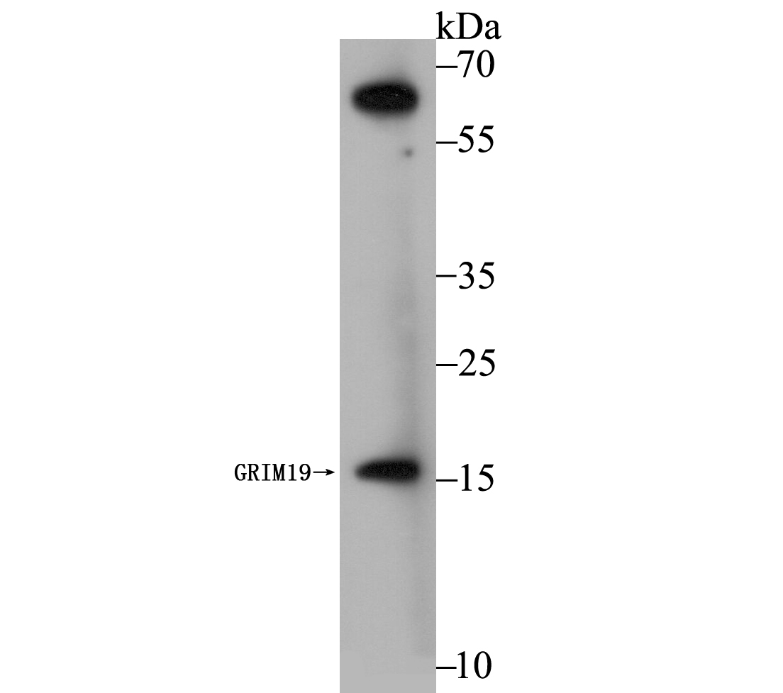 GRIM19 Rabbit mAb