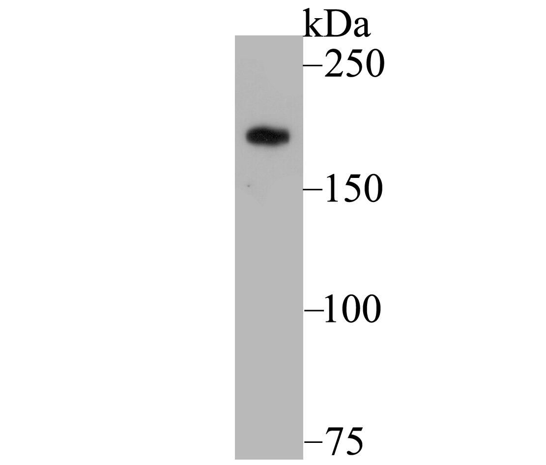 Gli3 Rabbit mAb