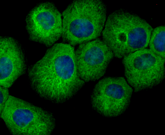 hUPF1 Rabbit mAb