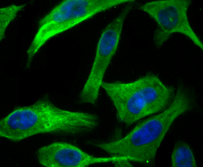 hUPF1 Rabbit mAb