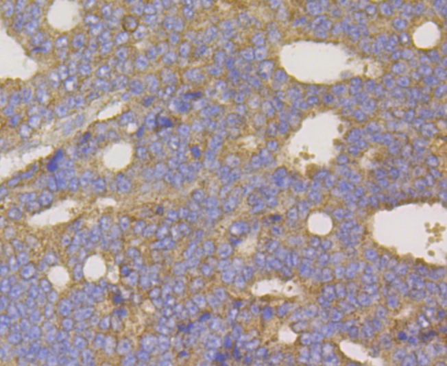 hUPF1 Rabbit mAb