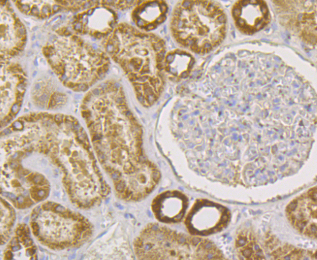 hUPF1 Rabbit mAb