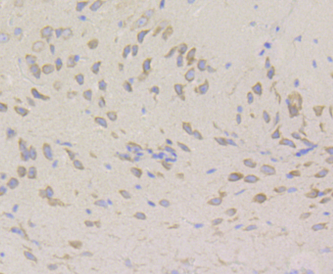 hUPF1 Rabbit mAb