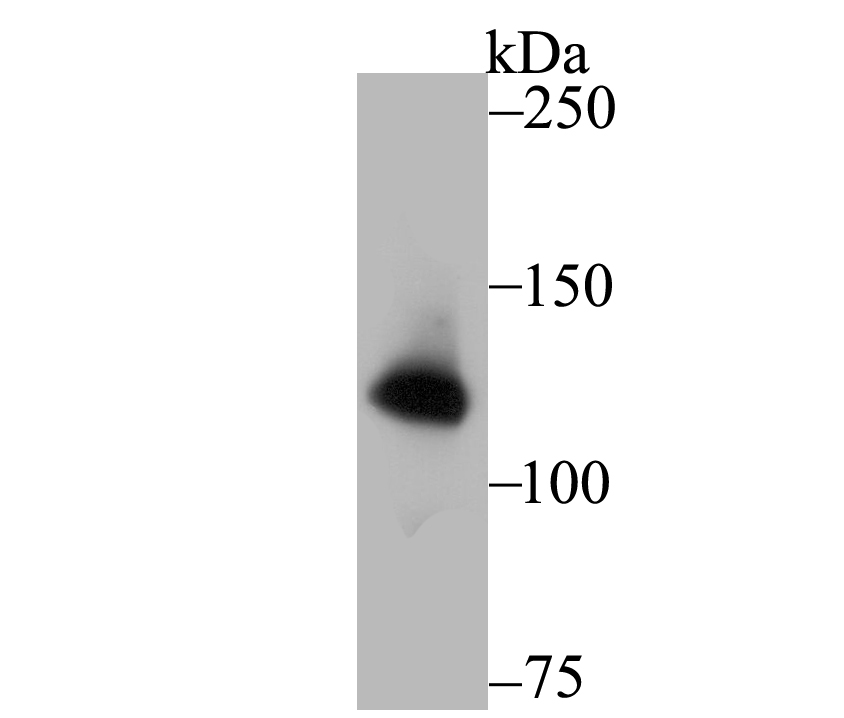 hUPF1 Rabbit mAb