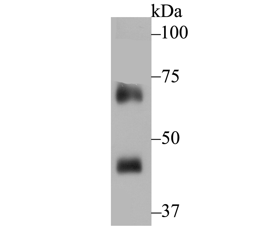 NOXA2 Rabbit mAb