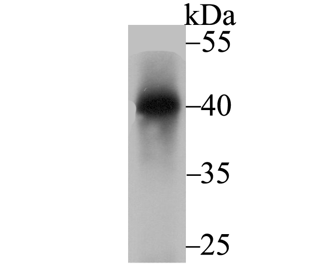 Nudel Rabbit mAb