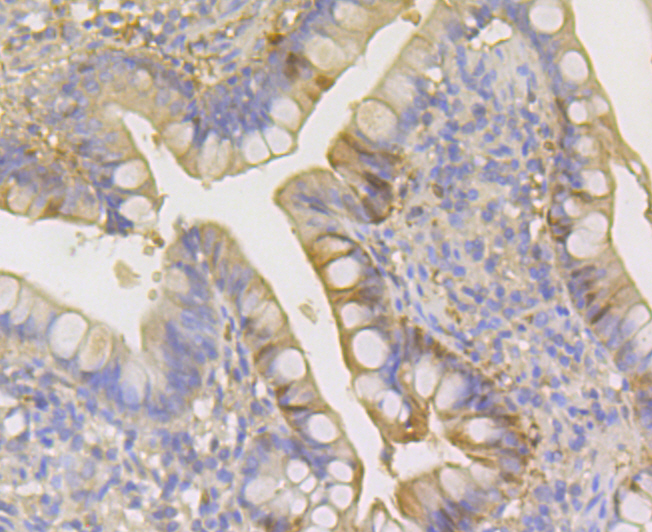 Carbonic Anhydrase I Rabbit mAb