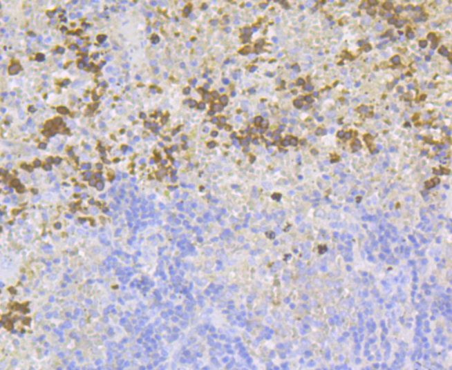 Carbonic Anhydrase I Rabbit mAb