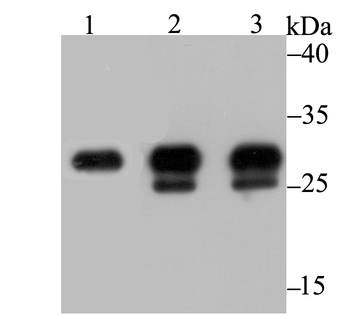 Carbonic Anhydrase I Rabbit mAb