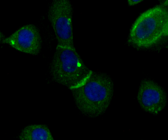 IQGAP1 Rabbit mAb