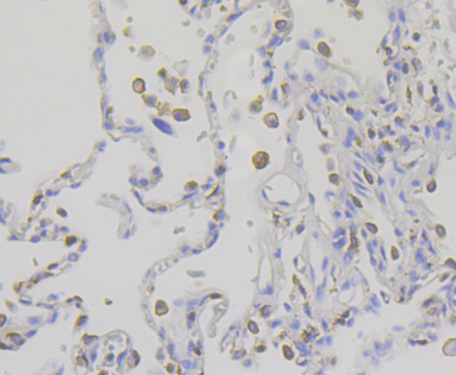 IQGAP1 Rabbit mAb