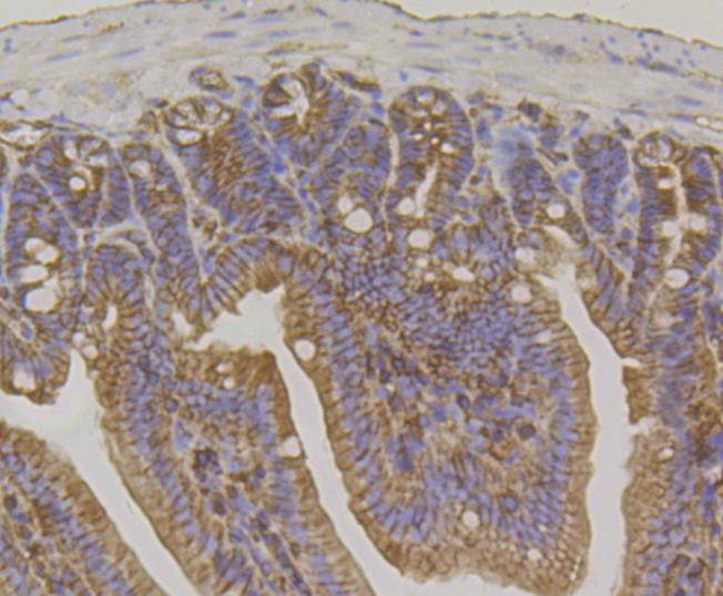 IQGAP1 Rabbit mAb