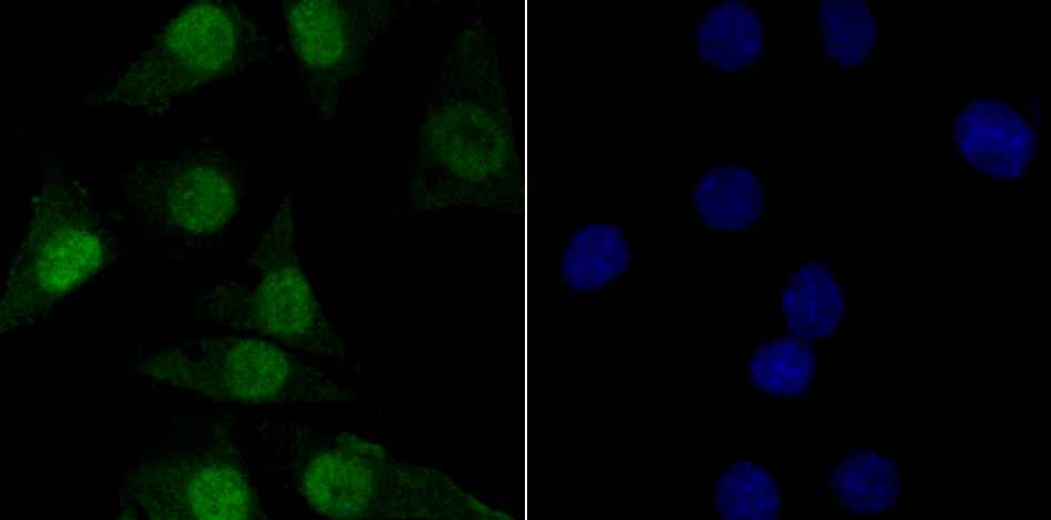 TNPO3 Rabbit mAb