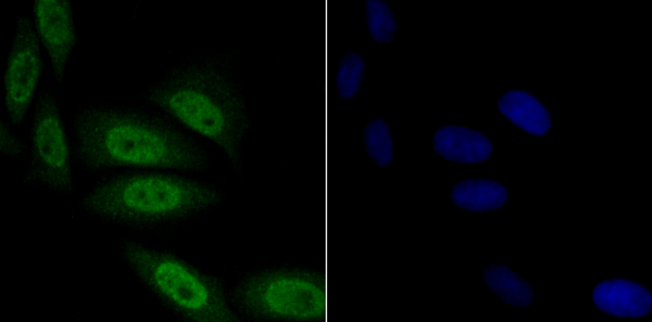 TNPO3 Rabbit mAb