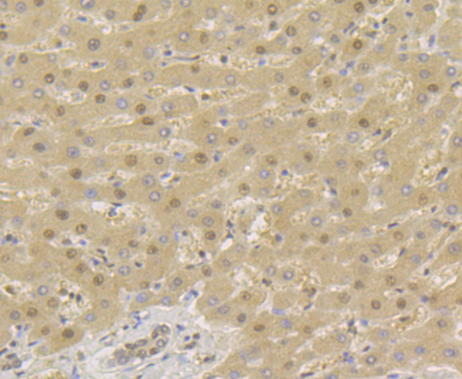 TNPO3 Rabbit mAb