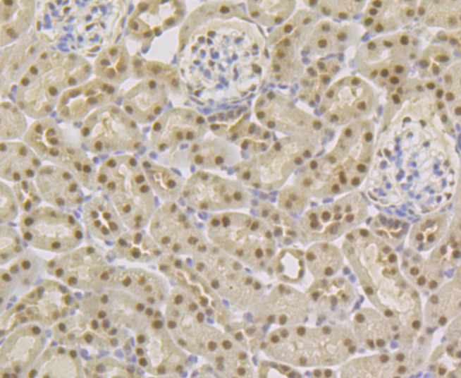 TNPO3 Rabbit mAb