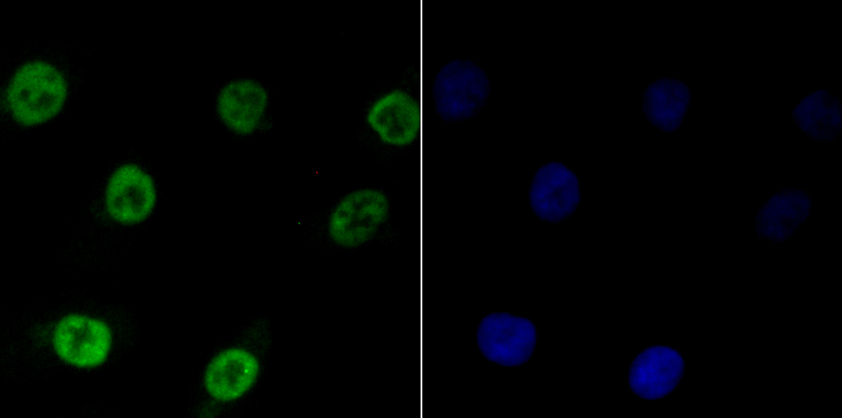 Bub3 Rabbit mAb