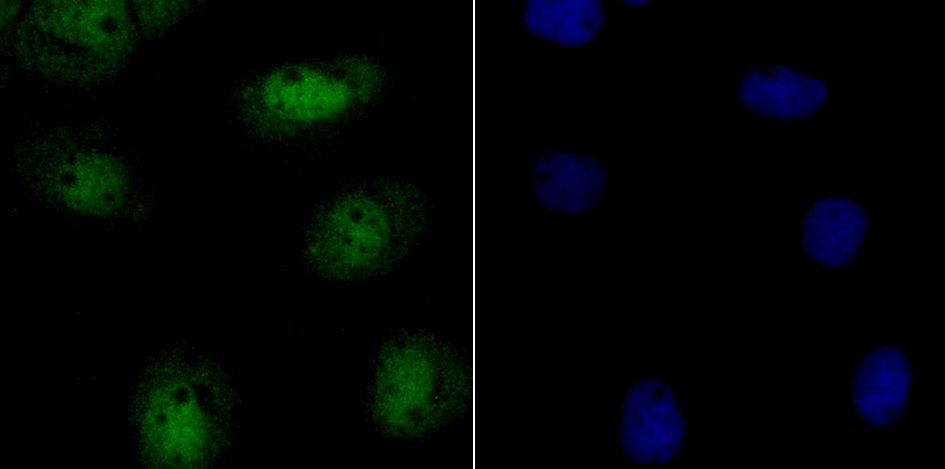 p150 CAF1 Rabbit mAb