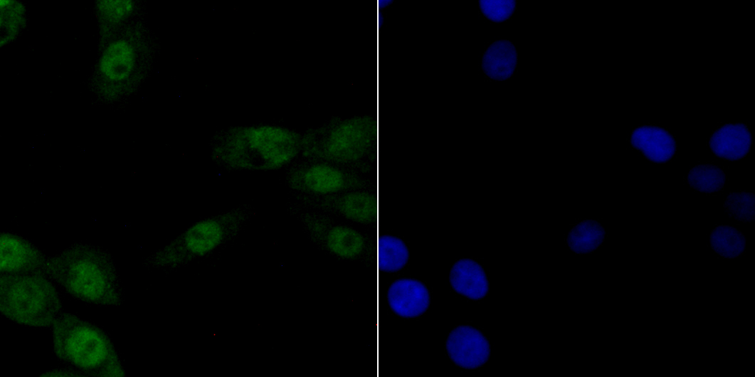 p150 CAF1 Rabbit mAb