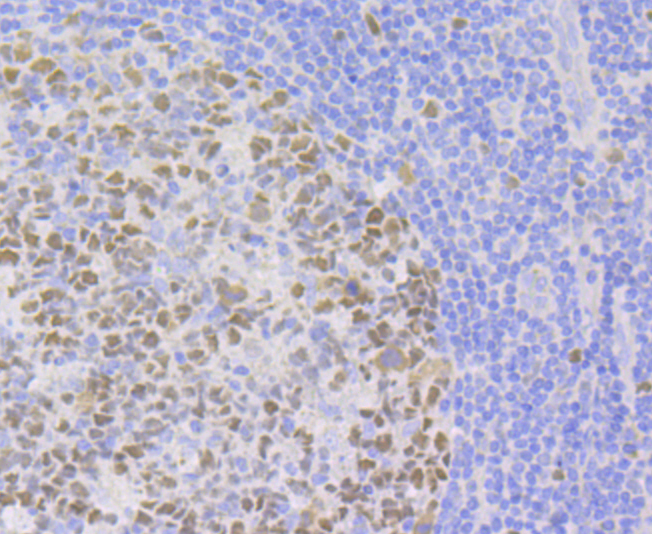 p150 CAF1 Rabbit mAb