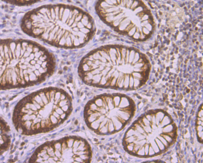 p150 CAF1 Rabbit mAb