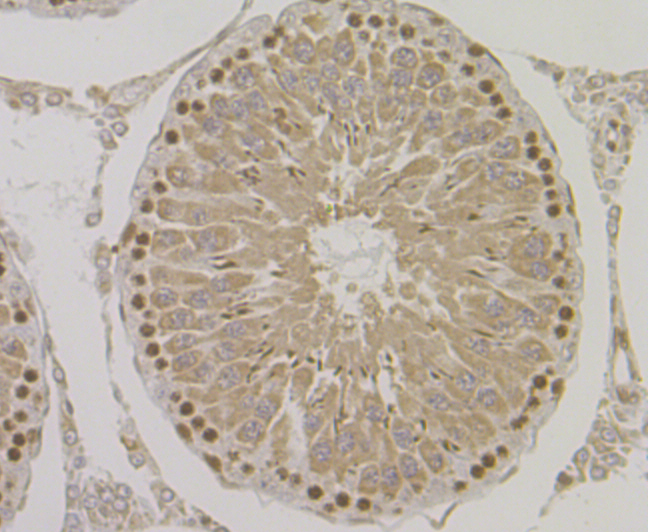 ORP150 Rabbit mAb