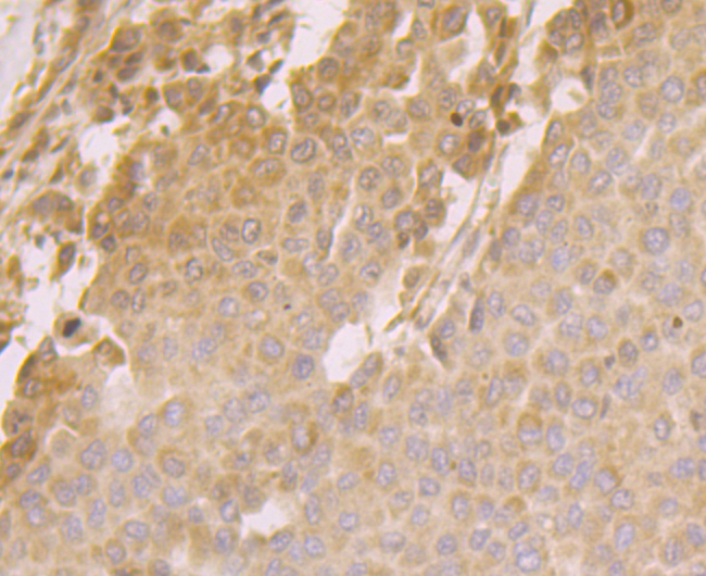 ORP150 Rabbit mAb