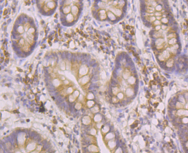 ORP150 Rabbit mAb