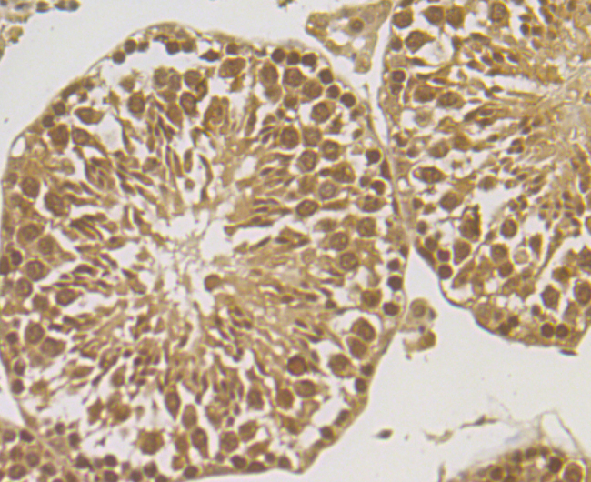 ORP150 Rabbit mAb