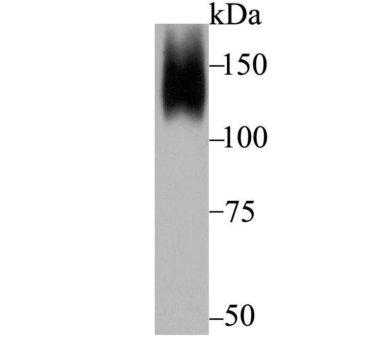 ORP150 Rabbit mAb