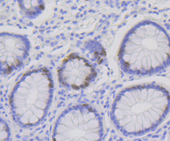 p60 CAF1 Rabbit mAb