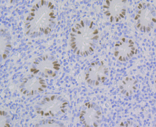 p60 CAF1 Rabbit mAb