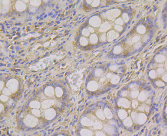 ADAMTS13 Rabbit mAb