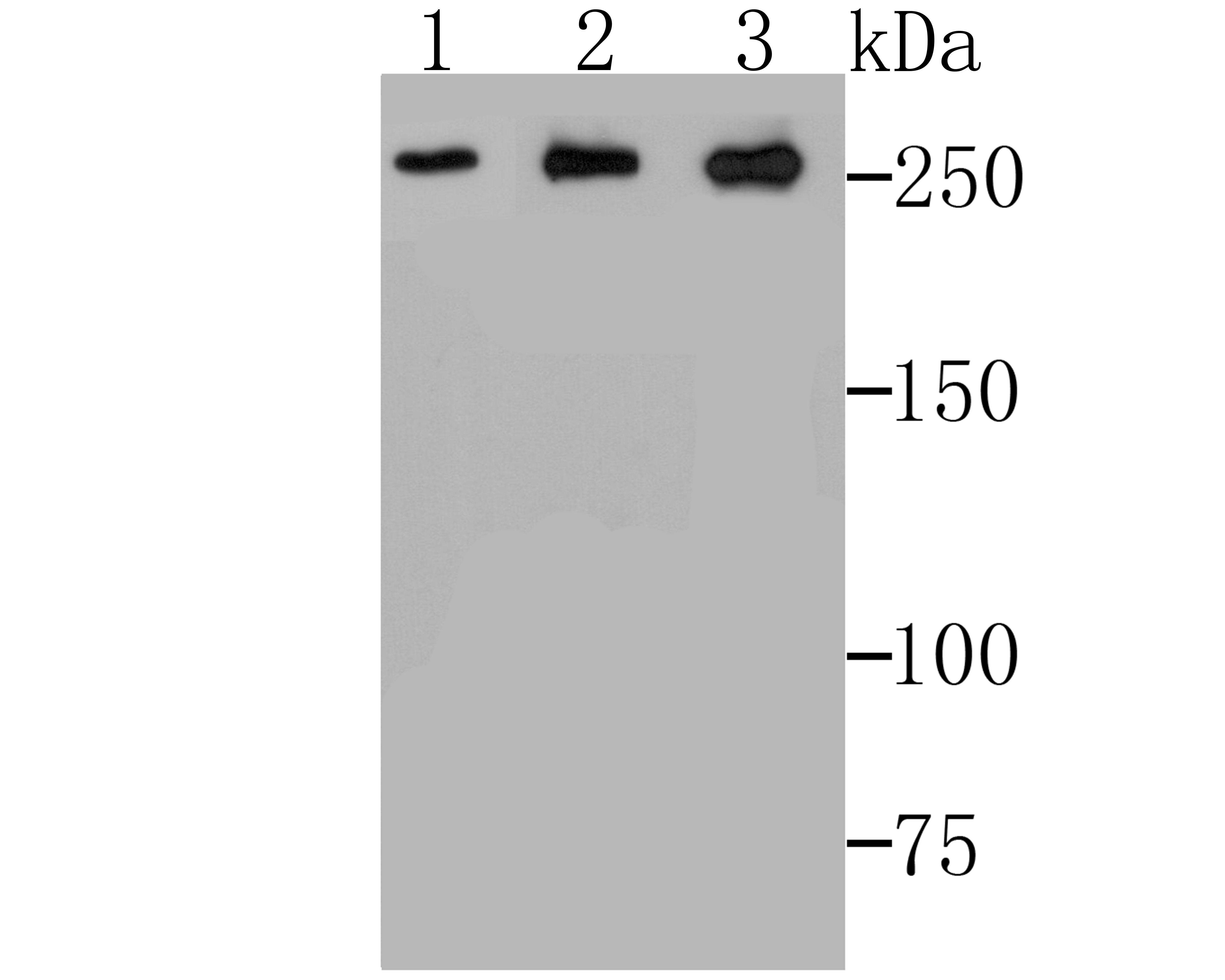 ADAMTS13 Rabbit mAb