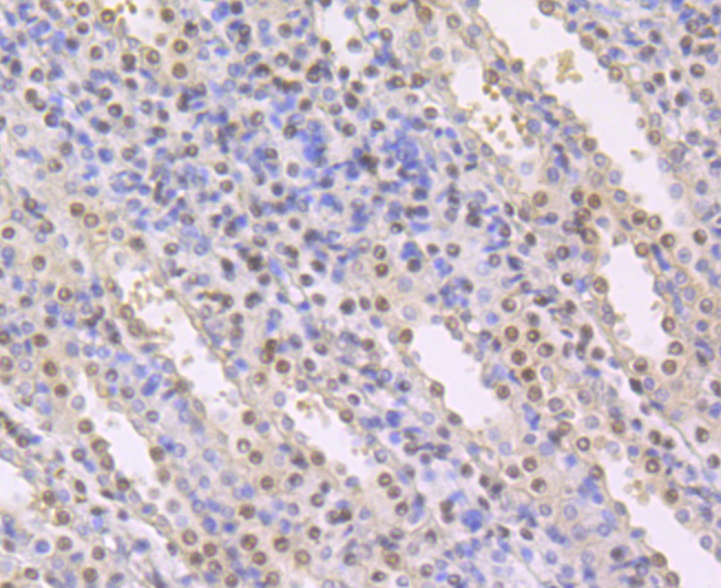 CBFb Rabbit mAb