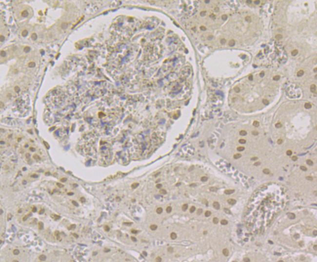 CBFb Rabbit mAb