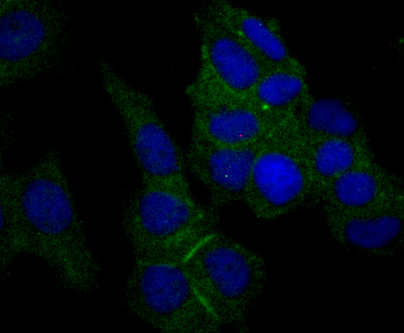 Nectin 2 Rabbit mAb