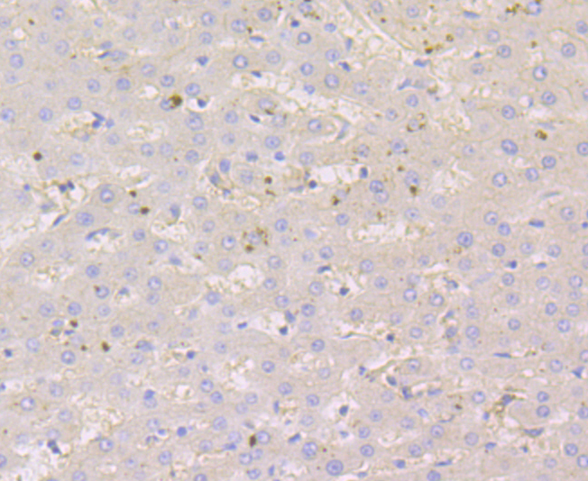 Nectin 2 Rabbit mAb